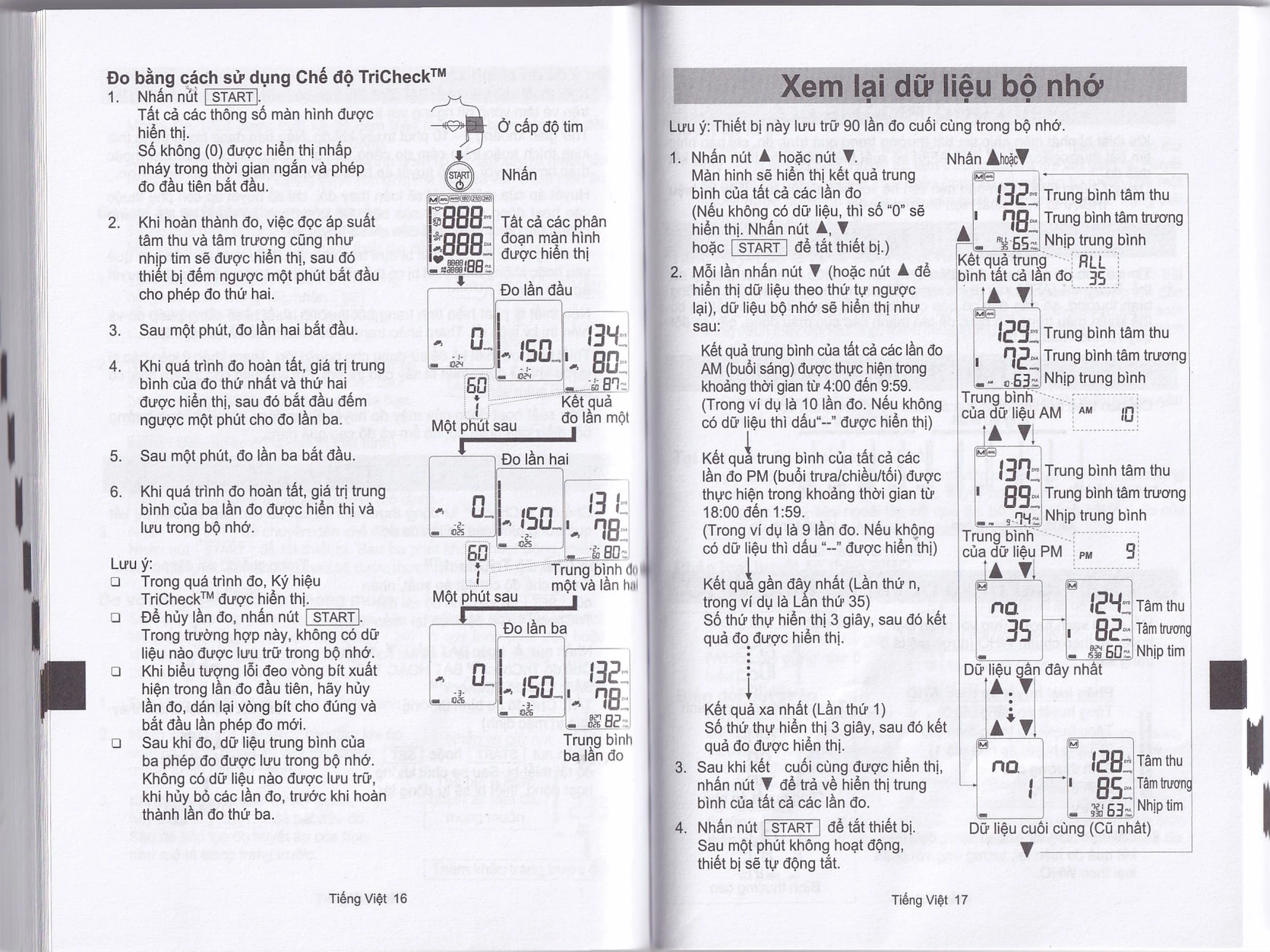 Máy đo huyết áp bắp tay AND UA-1020 Afib hỗ trợ đo huyết áp, cảnh báo đột quỵ