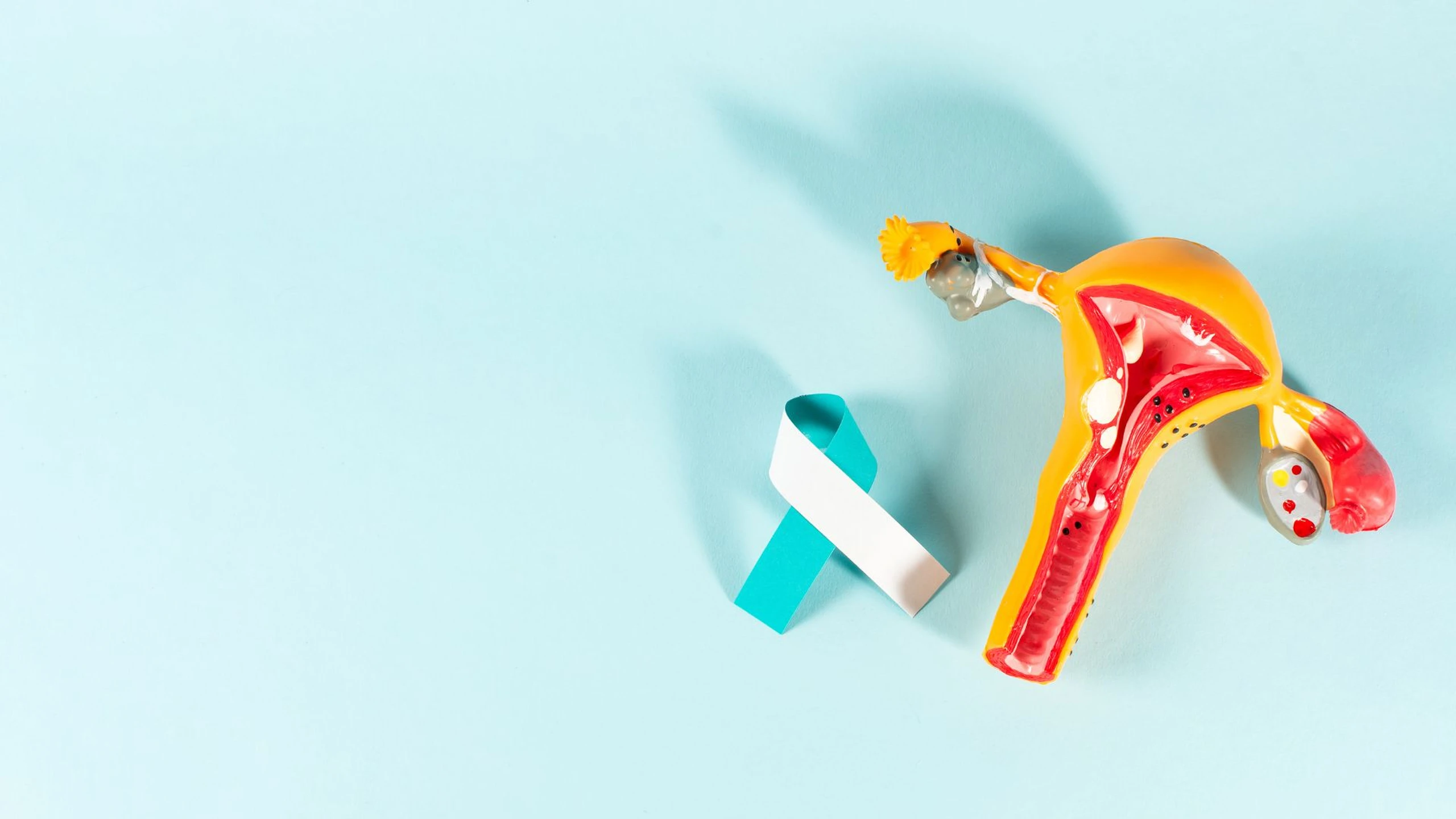 Ung thư cổ tử cung giai đoạn 3 sống được bao lâu? Một số biện pháp hỗ trợ ngăn ngừa ung thư tiến triển giai đoạn cuối