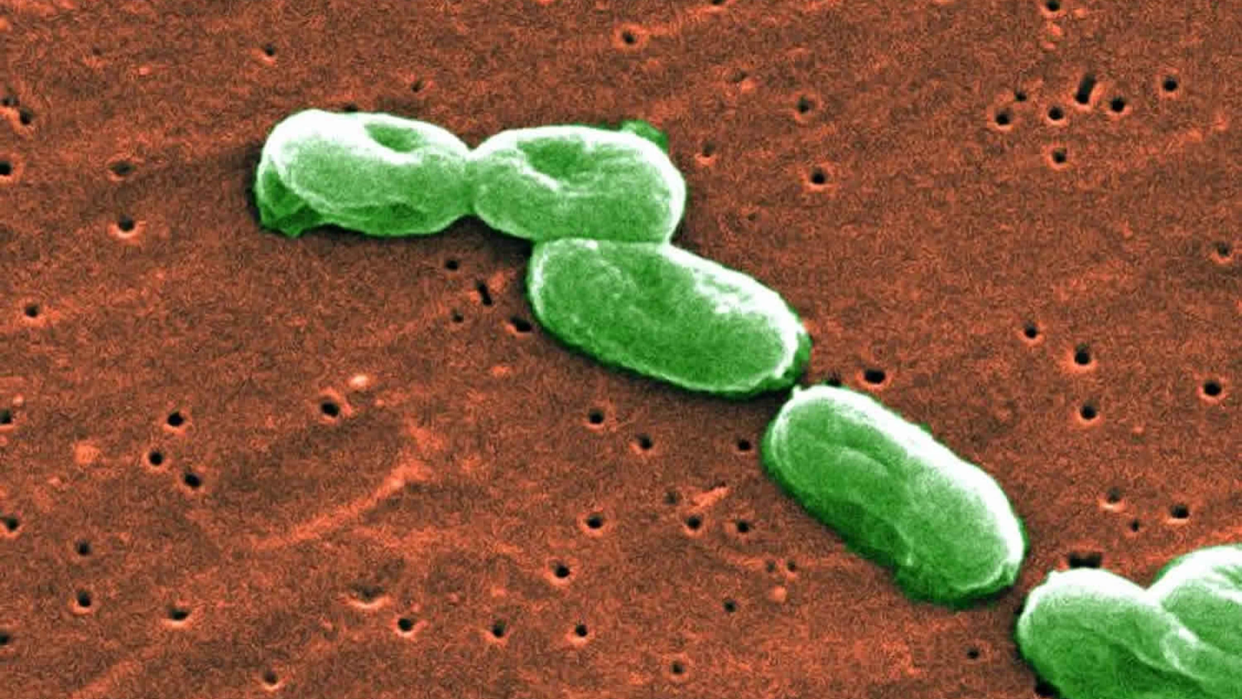 Vi khuẩn Burkholderia cepacia - Mầm bệnh gây nhiễm trùng bệnh viện 1