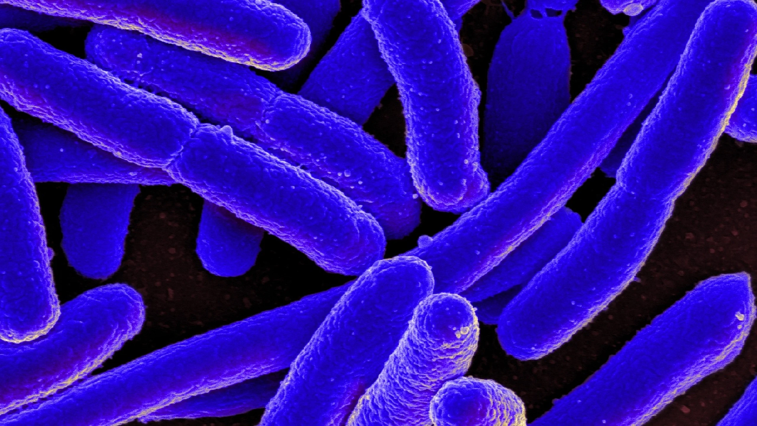 Vi khuẩn E coli: Đặc điểm, môi trường sinh sống và dấu hiệu nhận biết nhiễm trùng