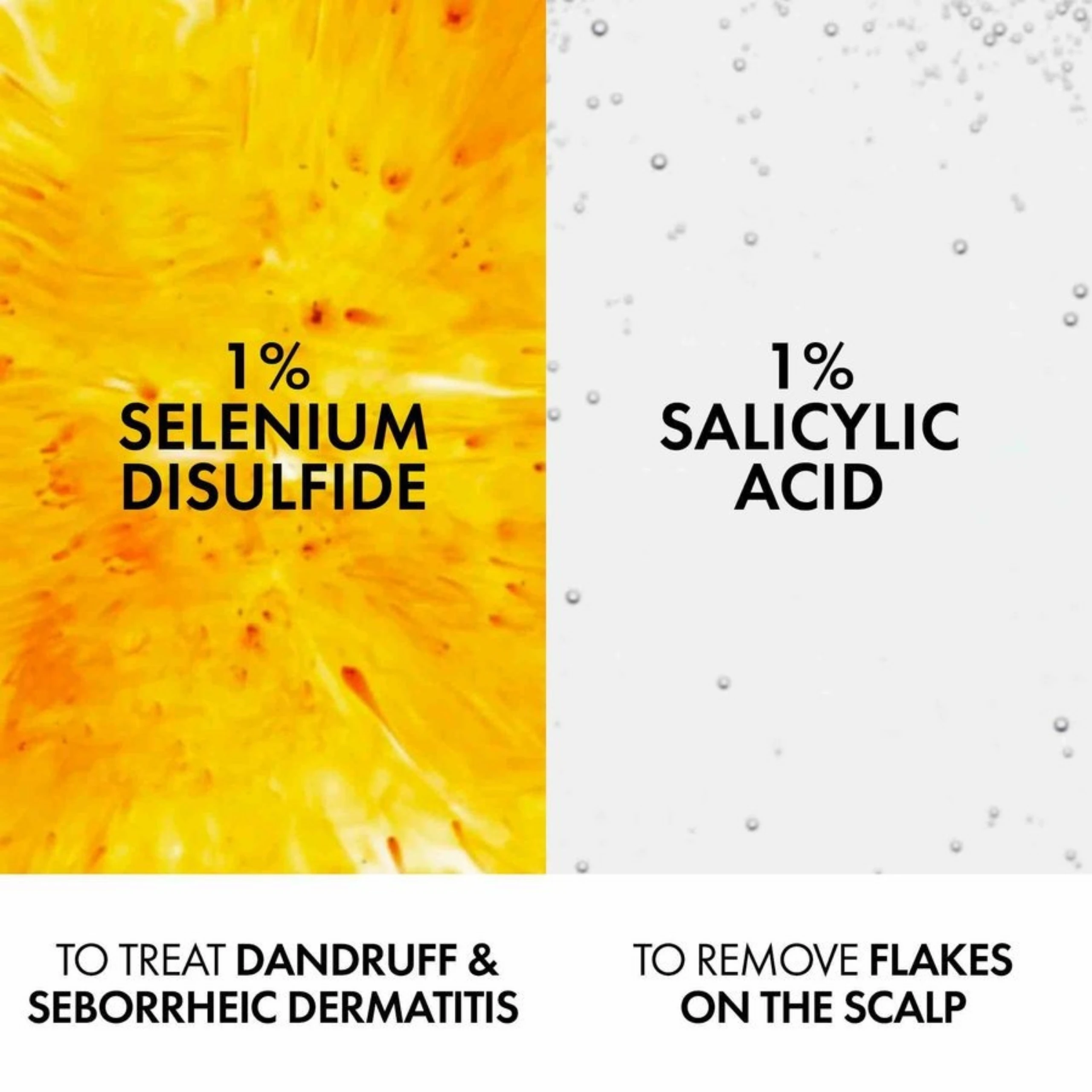 Dầu gội sạch gàu cho da đầu dầu Vichy Dercos Technique Anti Dandruff 200ml