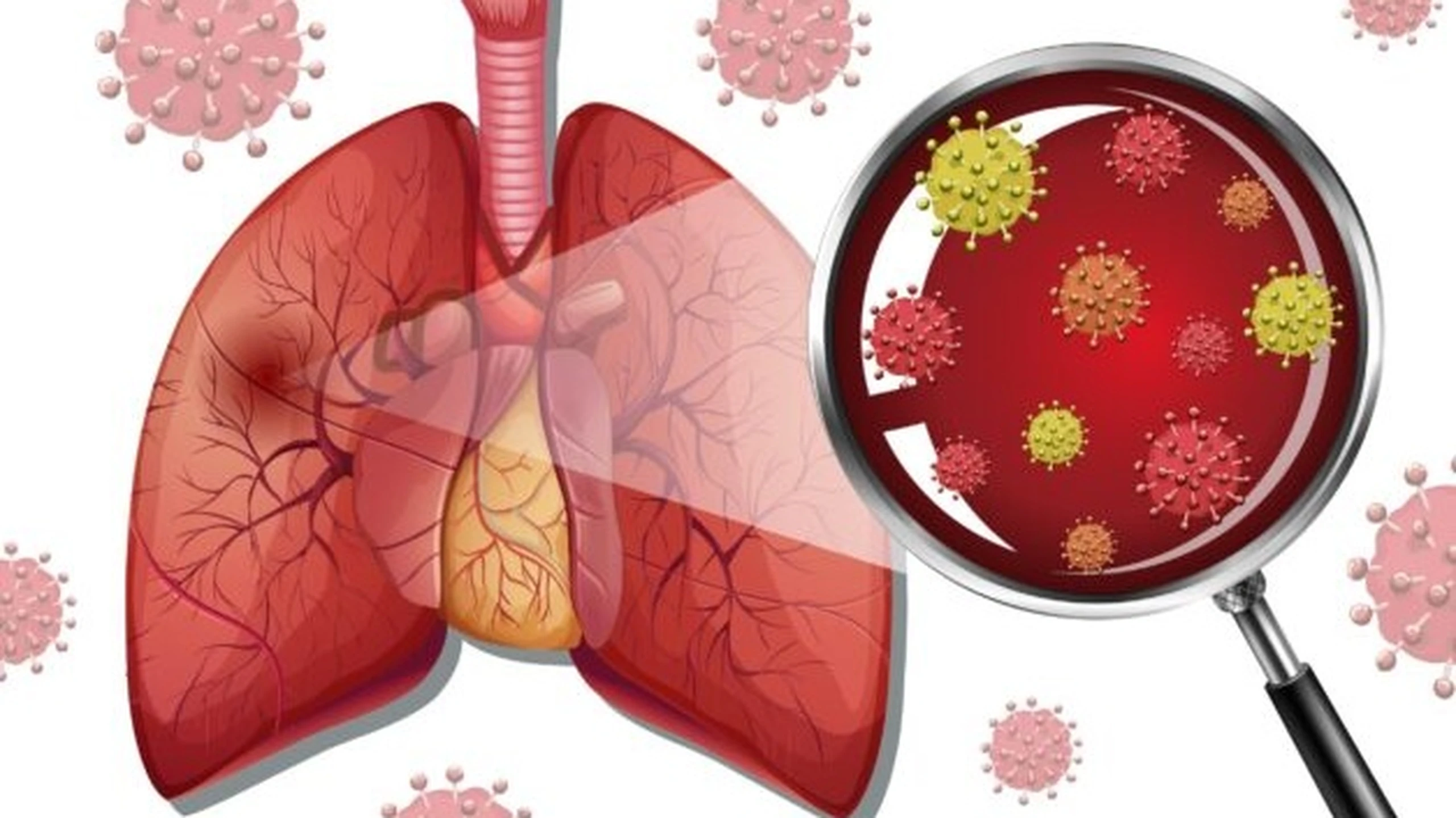 Viêm phổi tăng cảm là gì? Triệu chứng nhận biết và cách điều trị bệnh hiệu quả