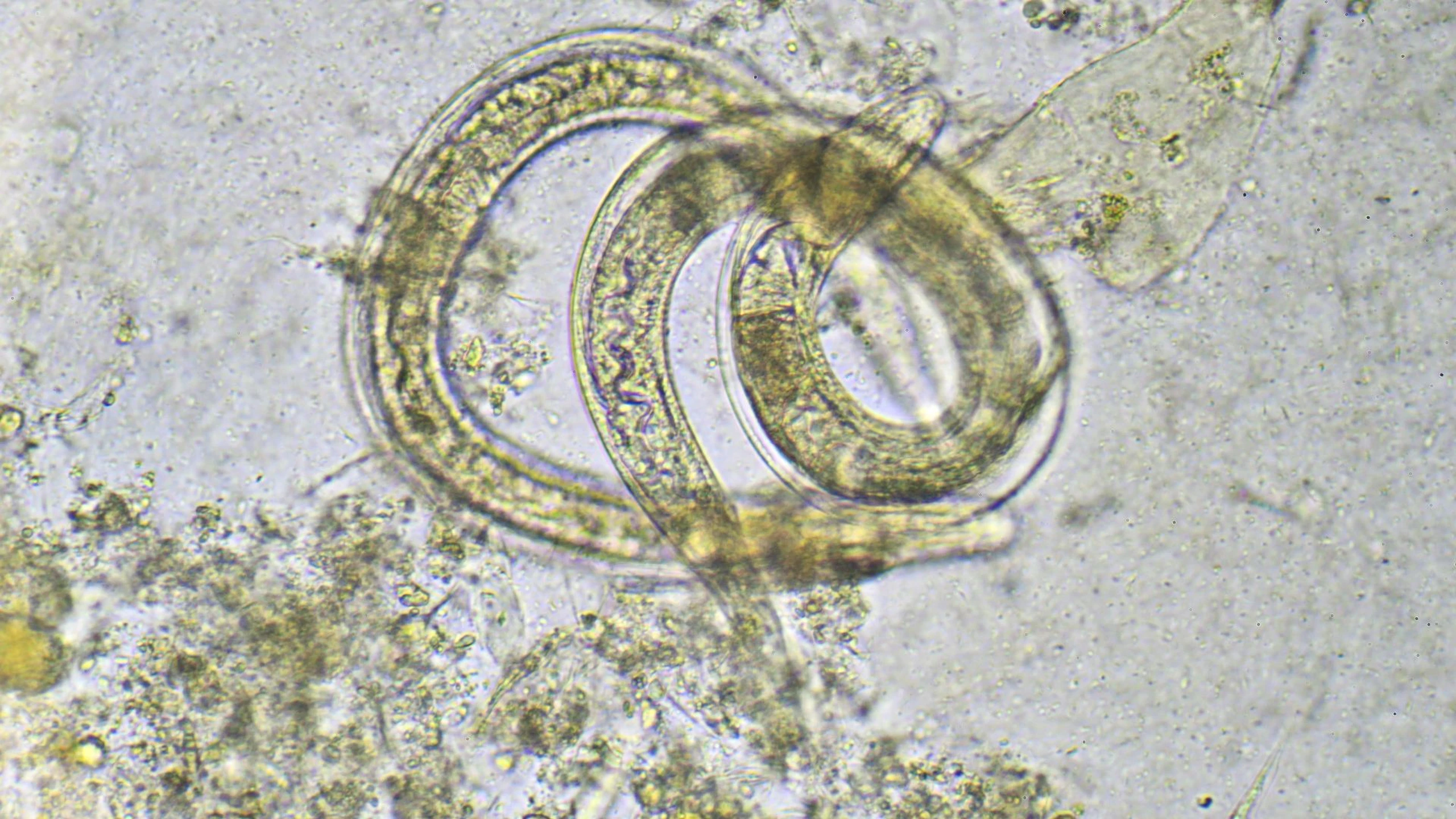 Xét nghiệm giun đũa: Khi nào cần thực hiện, các phương pháp xét nghiệm?