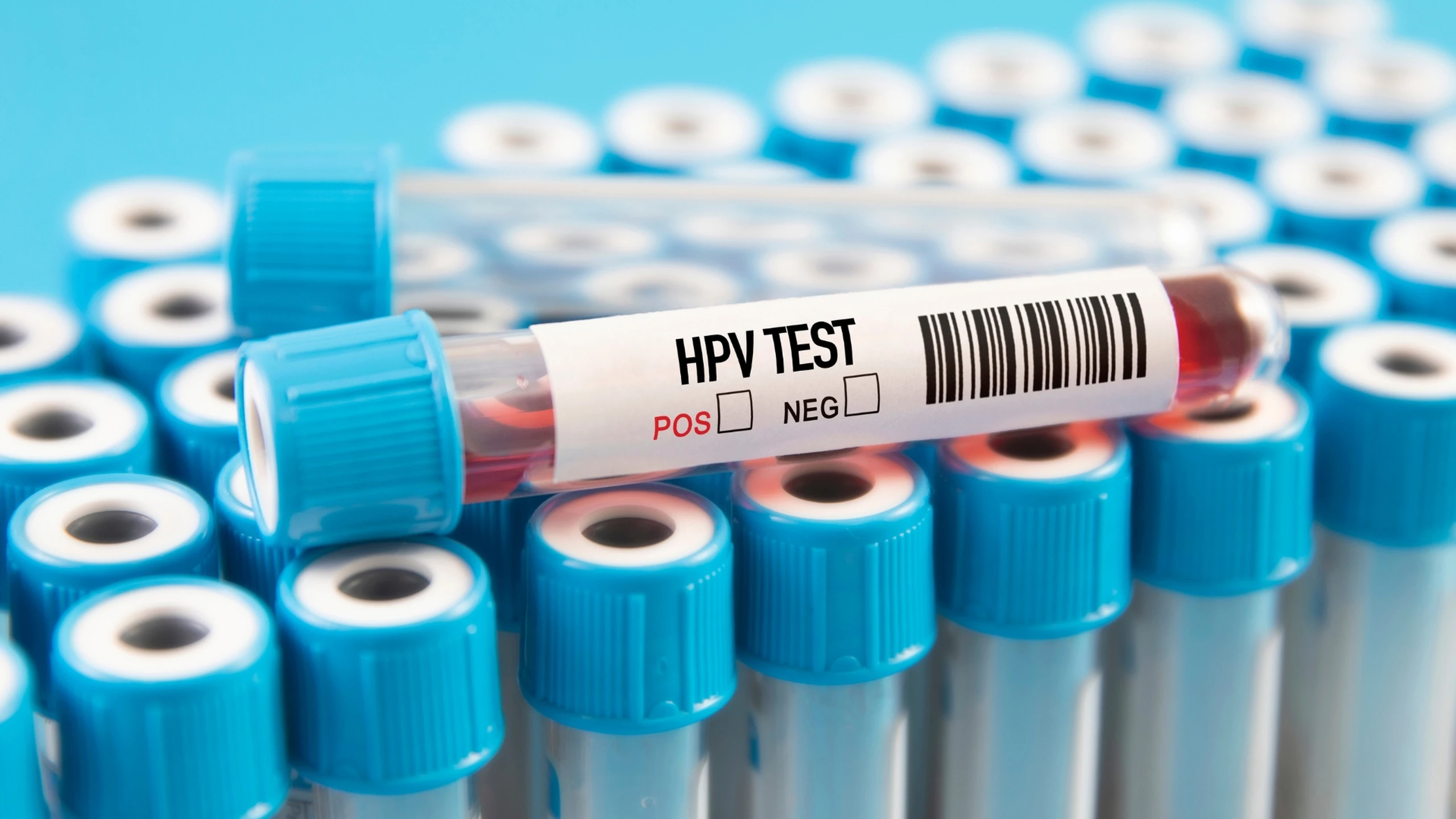 Xét nghiệm HPV là gì? Quy trình, chi phí và cách đọc kết quả 1