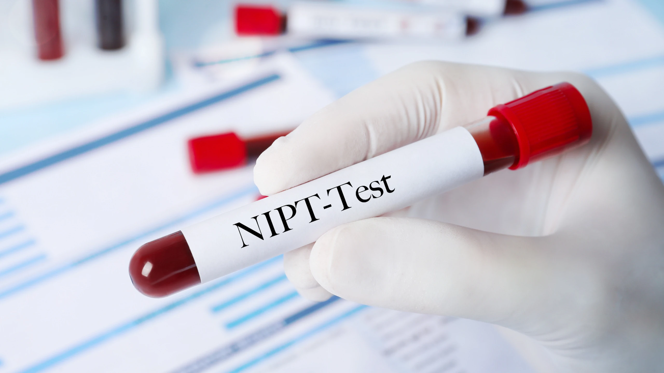 Xét nghiệm NIPT có cần đo độ mờ da gáy không? NIPT và đo độ mờ da gáy khác nhau như thế nào?