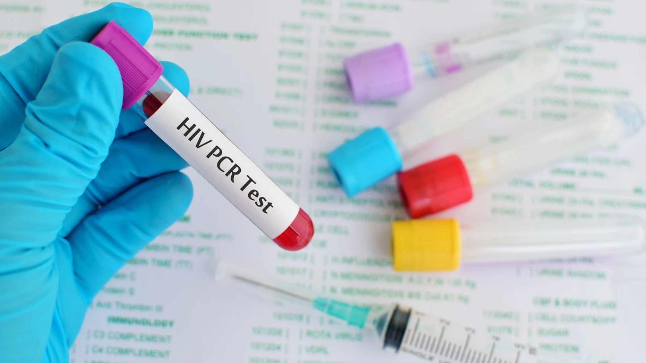 Xét nghiệm PCR HIV sau 7 ngày có được không? Thời điểm phù hợp