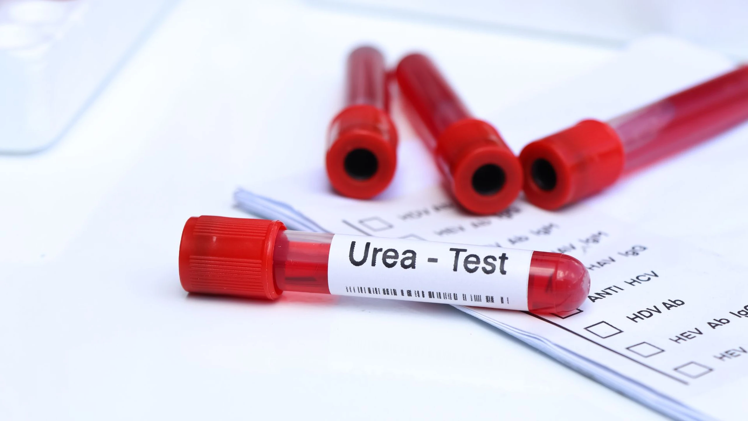 Xét nghiệm ure máu để làm gì? Lưu ý khi làm xét nghiệm ure máu