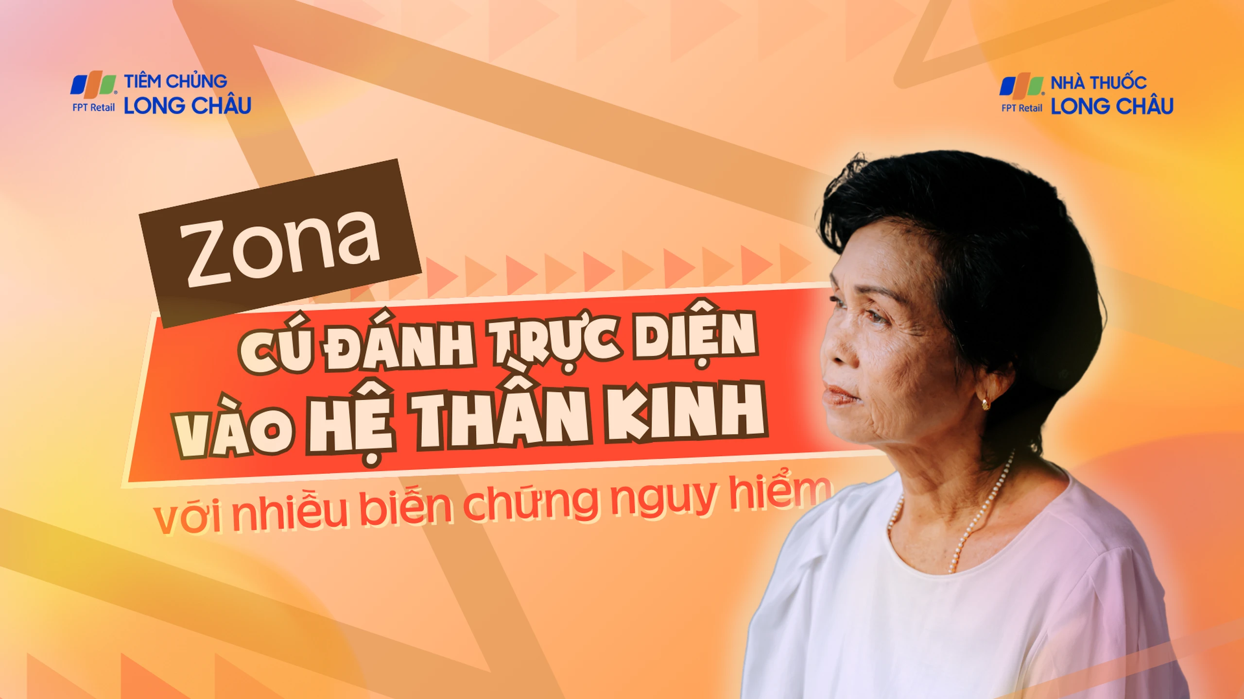 Zona - Cú đánh trực diện vào hệ thần kinh với nhiều biến chứng nguy hiểm