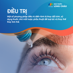 Đục thủy tinh thể 6