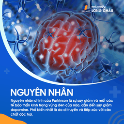 Nguyên nhân bệnh Parkinson - Các yếu tố gây rối loạn thần kinh và biện pháp phòng ngừa
