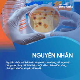 Hội chứng ruột kích thích 3