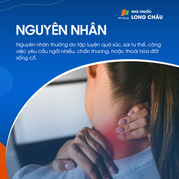 Nguyên nhân phổ biến gây đau cổ vai gáy: tư thế sai và căng cơ