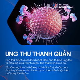 ung thư thanh quản 1