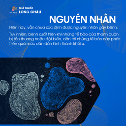 ung thư thanh quản 3