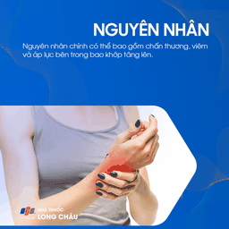Bướu Hoạt Dịch Cổ Tay 3