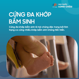 Cứng Đa Khớp Bẩm Sinh 1