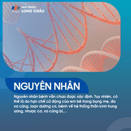 Cứng Đa Khớp Bẩm Sinh 3