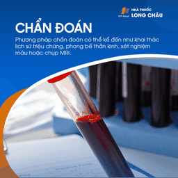 Đau đầu Arnold 5