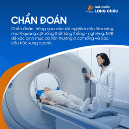 Thoái hóa cột sống thắt lưng 5