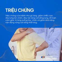 Xẹp Đốt Sống 2