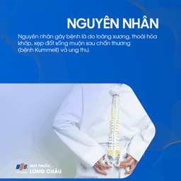 Xẹp Đốt Sống 3