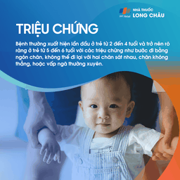 Xoắn Xương Đùi 2