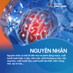 Áp lực nội sọ 4