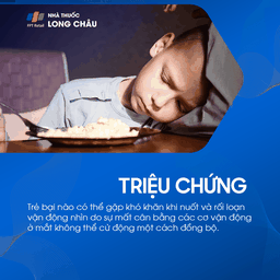 Trẻ bại não có thể gặp khó khăn khi nuốt và rối loạn vận động mắt do mất điều phối cơ