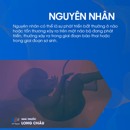 Nguyên nhân bại não là do bất thường phát triển hoặc tổn thương não trong thai kỳ hoặc sơ sinh