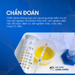 Bệnh thần kinh 5