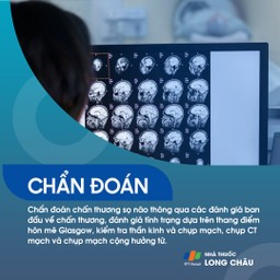 Chẩn đoán dựa trên thang điểm Glasgow, chụp CT, MRI và đánh giá thần kinh.
