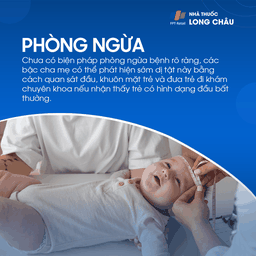 Chứng dính liền khớp sọ sớm 7