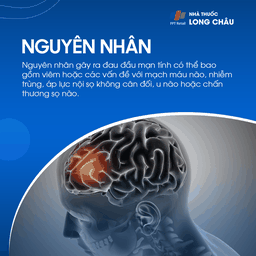 Đau đầu mạn tính 3