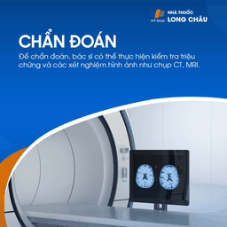 Đau đầu mạn tính 5