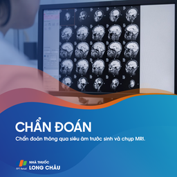 Dị dạng bán cầu não 5