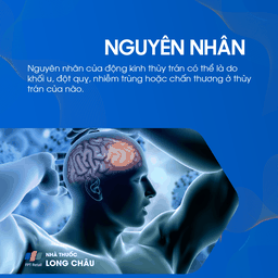 Động kinh thùy trán 3