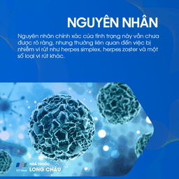 Liệt mặt ngoại biên 3