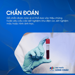 Liệt mặt ngoại biên 5