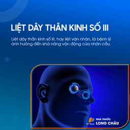 Liệt dây thần kinh số III 1