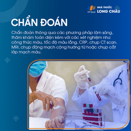 Liệt dây thần kinh số III 5