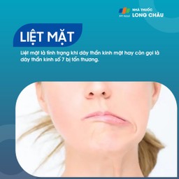 Liệt mặt 1