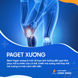 paget xương 1