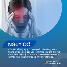 Phình động mạch não 4