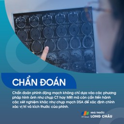 Phình động mạch não 5