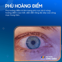 Phù hoàng điểm 1