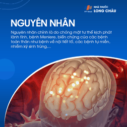 Rối loạn tiền đình ngoại biên 3