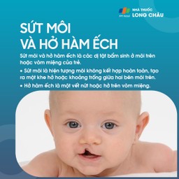 Sứt môi và hở hàm ếch 1