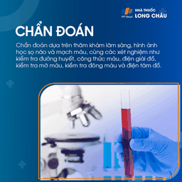 Cơn thiếu máu não cục bộ thoáng qua 5