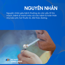 Thiểu năng tuần hoàn não 3