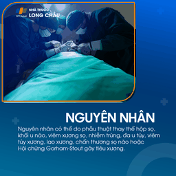 Tiêu xương sọ 3